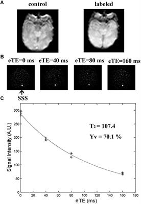 Neurophysiologic Profiling of At-Risk Low and Very Low Birth-Weight Infants Using Magnetic Resonance Imaging